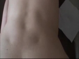 anus a bite